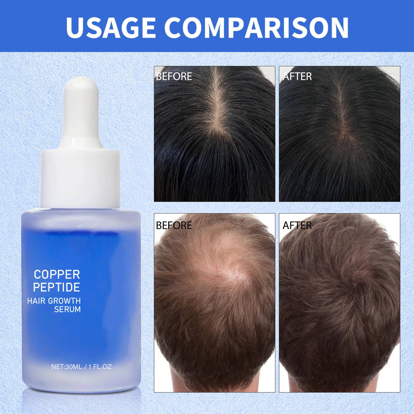 Blue Copper Peptide Hair Essence – Hair Growth & Scalp Care Serum 30ml