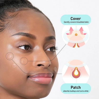 Olive Young Care Plus Spot Cover Spot Patch,Hydrogel Texture,Skin-Conforming,Blemish Skin,Soothing Care,K-Beauty,Korean Makeup