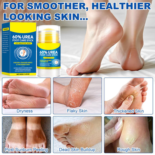 Salicylic Acid & Urea Hand and Foot Care Stick – Anti-Crack Moisturizing Balm, view 2