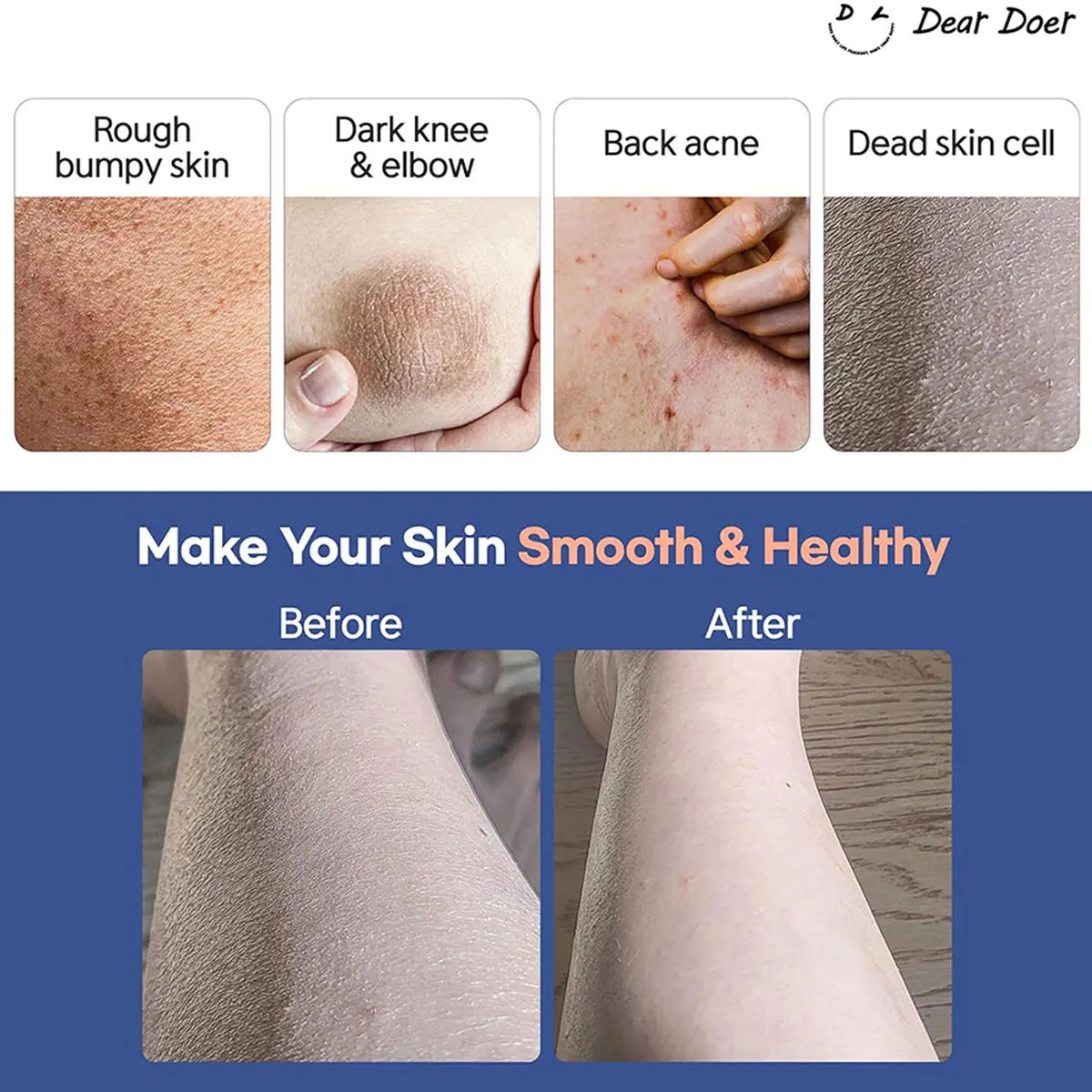 [ClearanceSale] DearDoer Vegan Body Scrub The Hidden 300ml,Granular Texture,Gentle & Non-Irritating,K-Beauty,Korean Makeup