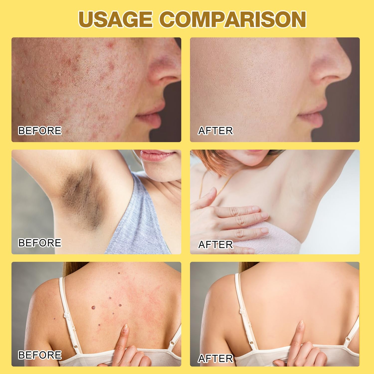 2-Pack Bee Venom Cream - Advanced Skin Treatment for All Body Areas (2.12 Oz)