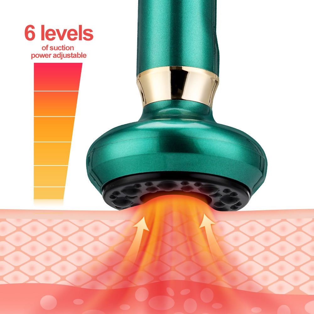 Electric Cupping Therapy Set – Heated Massage & Suction Recovery Kit