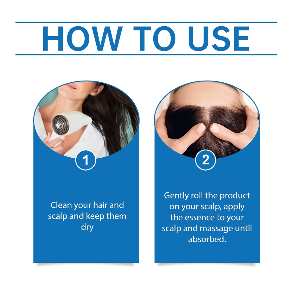 25Mlhair Care Serum Roll-On Prevent Hair Loss Baldness Scalp Massage Repair Dry Damaged Hair 3% Rosemary Nourishing Hair Essence