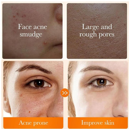 Turmeric Foaming Facial Cleanser with Brush - 2 Piece Exfoliating and Gentle Cleansing Set for Radiant Skin