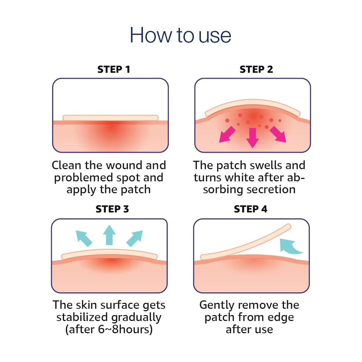 Olive Young Care Plus Spot Cover Spot Patch,Hydrogel Texture,Skin-Conforming,Blemish Skin,Soothing Care,K-Beauty,Korean Makeup