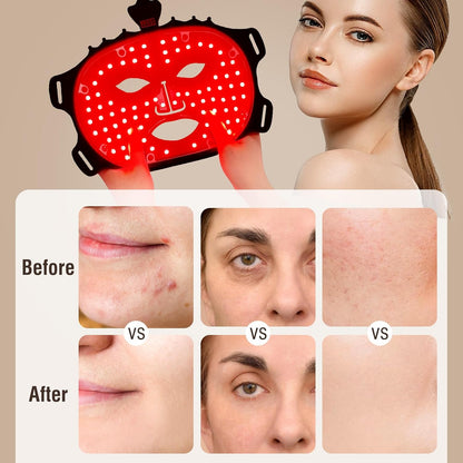 7-Color LED Red Light Therapy Face Mask for Anti-Aging and Skin Care, Featuring Eye Protection Cushion for Home Use