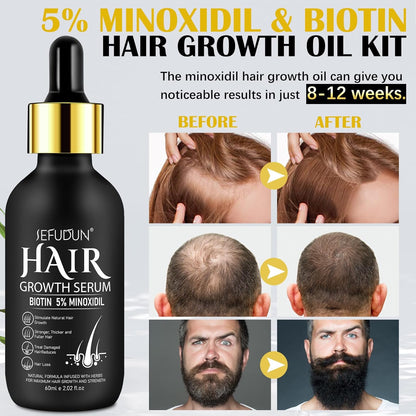 5% Minoxidil Hair Growth Serum Kit - Hair Regrowth Treatment for Scalp Hair Loss and Thinning with Biotin, 2.02 Fl Oz, One Month Supply