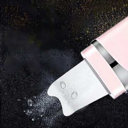 Ultrasonic Blackhead Remover & Acne Pore Cleansing Device – Skin Scrubber