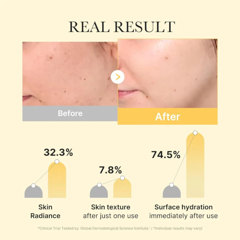 medicube Kojic Acid Turmeric Brightening Gel Mask – Jelly Sheet Mask