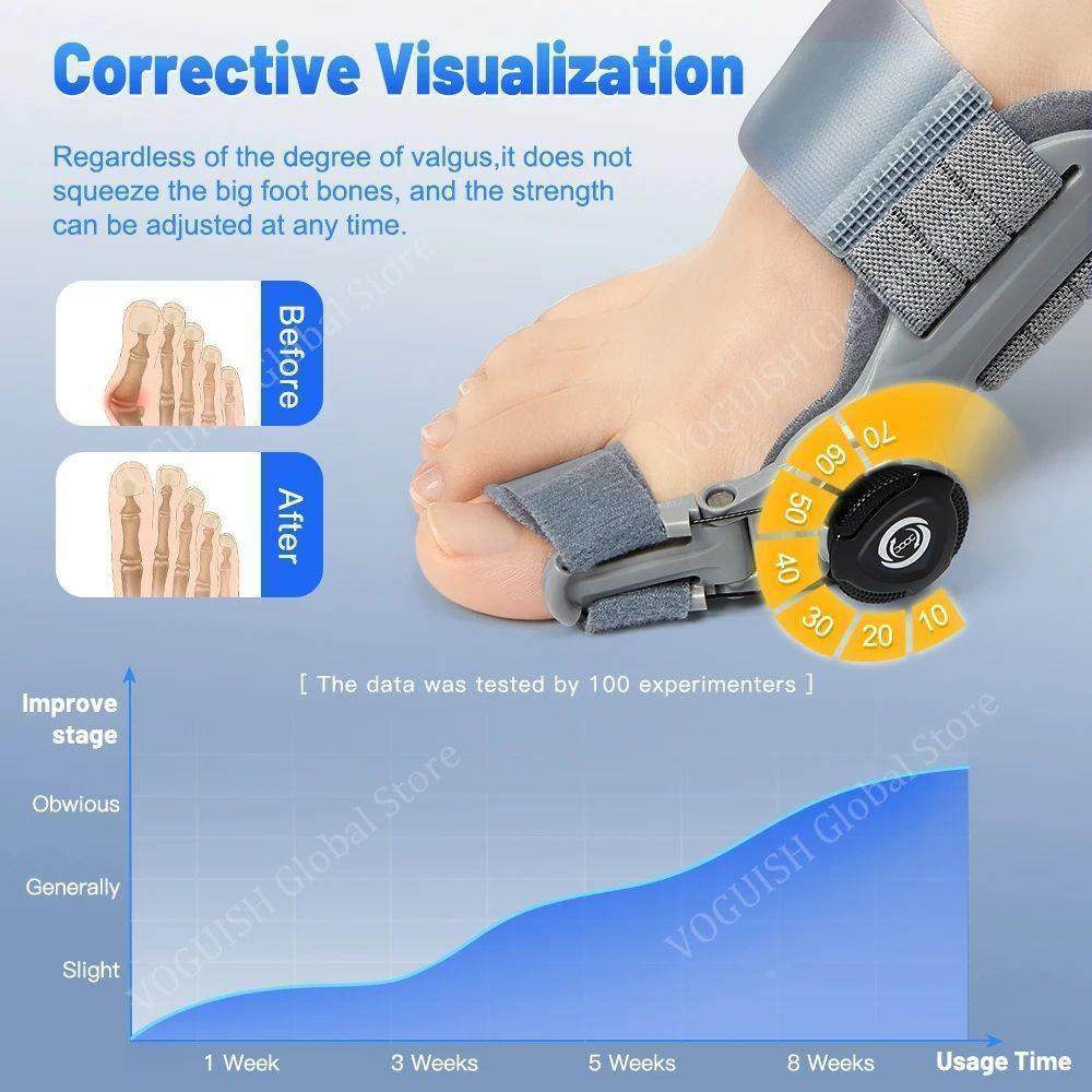 Bunion Corrector Splint – Adjustable Nighttime Hallux Valgus Support