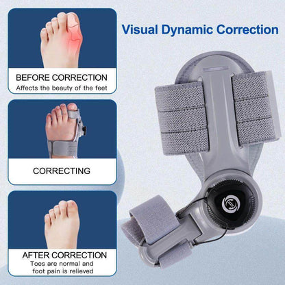 Bunion Corrector Splint – Adjustable Nighttime Hallux Valgus Support