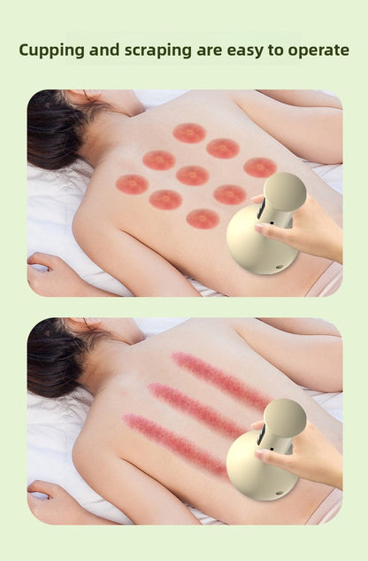 Smart Electric Gua Sha Device – Heated Scraping & Cupping Tool