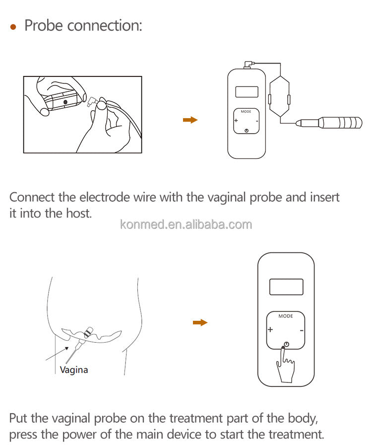 Pelvic Floor Muscle Pain Improve Sexual Life Kegel Exercise