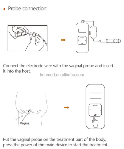 Pelvic Floor Muscle Pain Improve Sexual Life Kegel Exercise