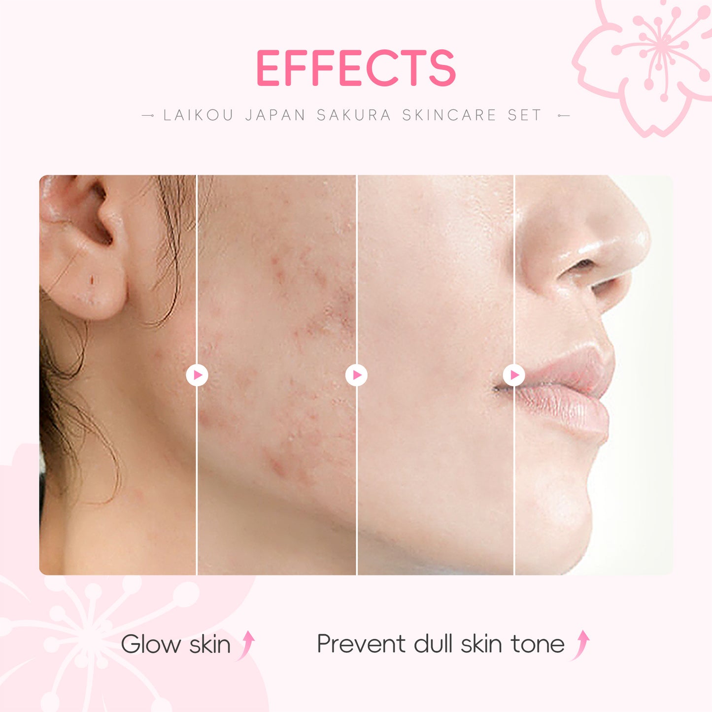 Lecco Japanese Cherry Blossom Skin Care 5-Piece Set