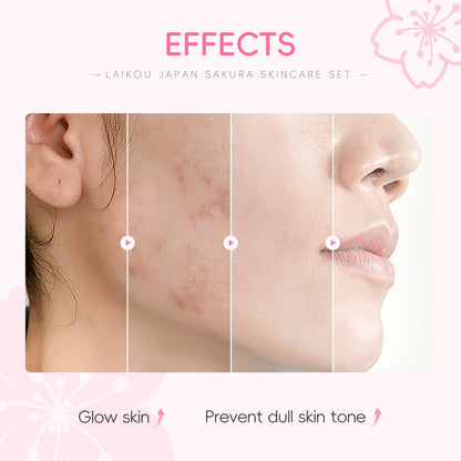 Lecco Japanese Cherry Blossom Skin Care 5-Piece Set