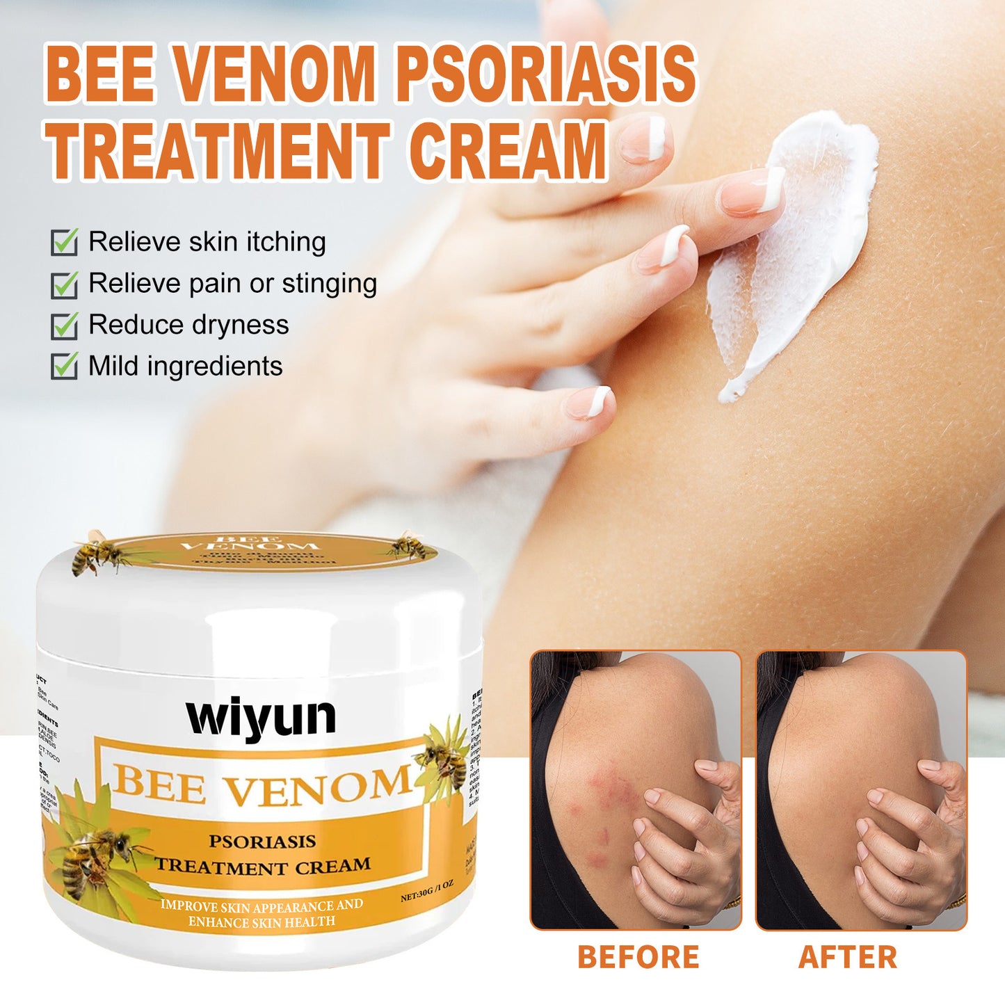 WIYUN Bee Venom Pseudonia, Moss Cream Repairs Itchy Hands and Feet, Moisturizes and Smoothes Skin, Care Cream Feet