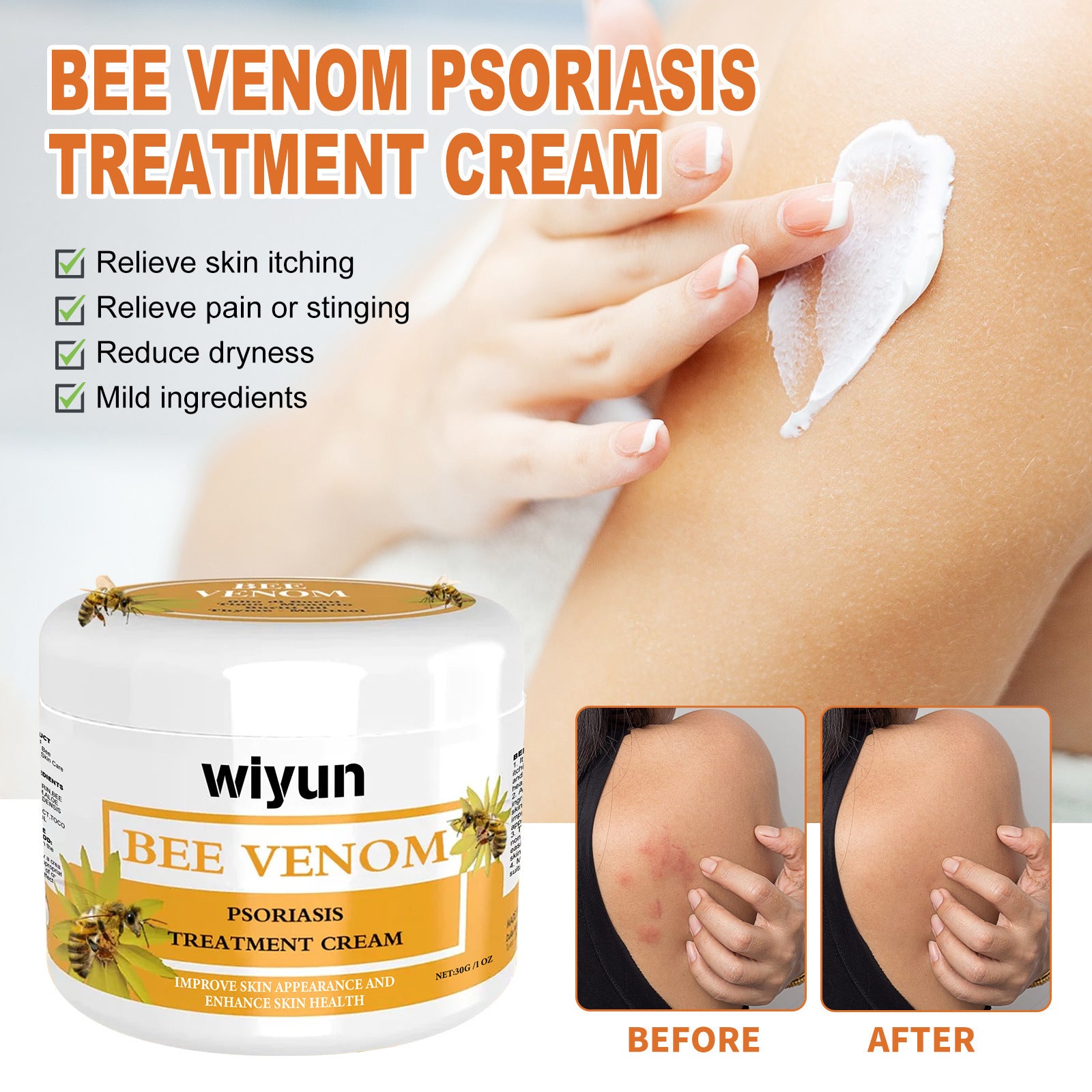 WIYUN Bee Venom Pseudonia, Moss Cream Repairs Itchy Hands and Feet, Moisturizes and Smoothes Skin, Care Cream Feet