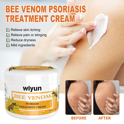 WIYUN Bee Venom Pseudonia, Moss Cream Repairs Itchy Hands and Feet, Moisturizes and Smoothes Skin, Care Cream Feet
