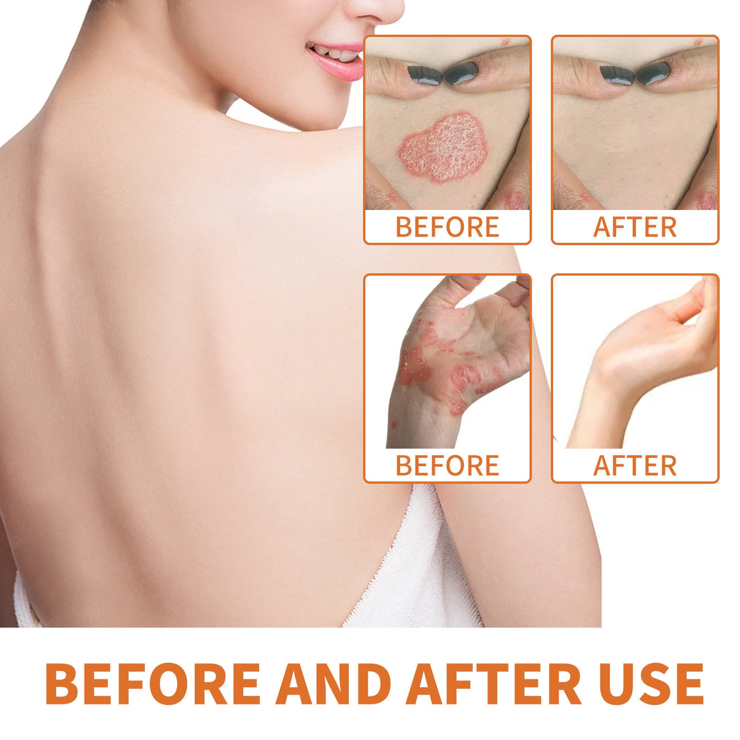 WIYUN Bee Venom Pseudonia, Moss Cream Repairs Itchy Hands and Feet, Moisturizes and Smoothes Skin, Care Cream Feet