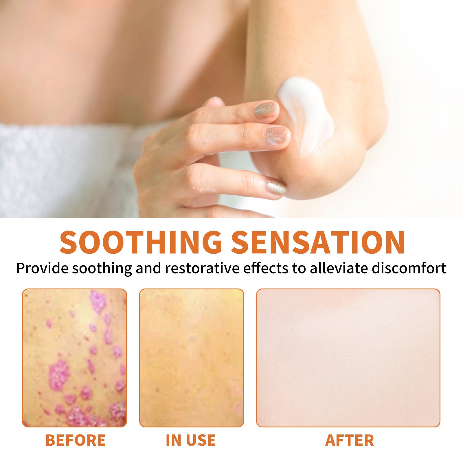 WIYUN Bee Venom Pseudonia, Moss Cream Repairs Itchy Hands and Feet, Moisturizes and Smoothes Skin, Care Cream Feet