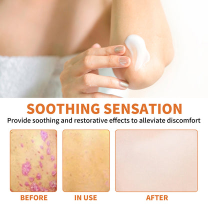 WIYUN Bee Venom Pseudonia, Moss Cream Repairs Itchy Hands and Feet, Moisturizes and Smoothes Skin, Care Cream Feet