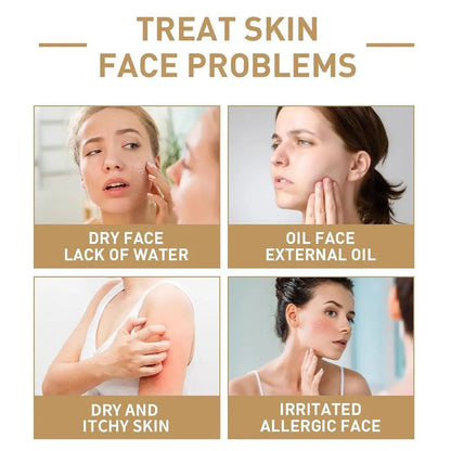 Anua Rice 70 Glow Milky Toner and Rice Ceramide Cleansing Foam for Long-Lasting Moisturization and Gentle Deep Nourishment