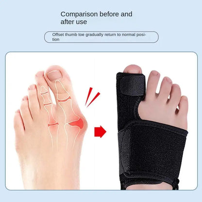 Toe Valgus Correction Brace with Stabilizing Strap for Thumb Injury and Foot Alignment Support