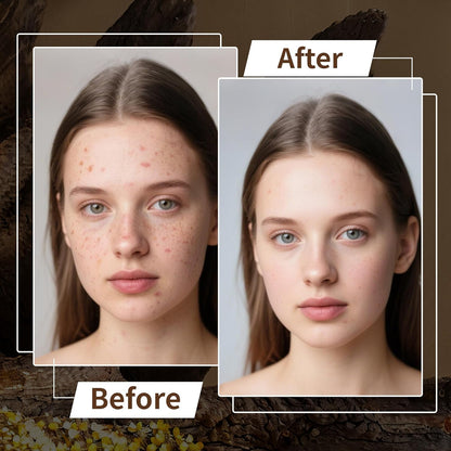 Beef Tallow for Skin - Homemade Beef Tallow and Honey Balm Moisturizer - Natural Grass - Fed Beef Tallow Skincare with Raw Honey Moisturizing Cream for Face Body Lotion Skin Care (3.9 OZ, Lavender)