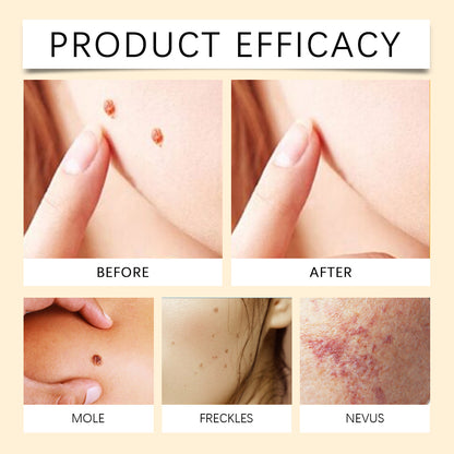 Bee Venom Skin Tag Removal Cream – Gentle Moisturizing Formula for Clear, Smooth-Looking Skin, 59 g