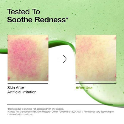 Anua Azelaic Acid 10 Hyaluron Redness Soothing Serum – Gentle Redness Care