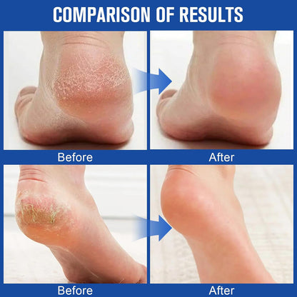 Hand and Foot Care Stick